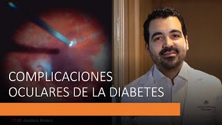 ⚠️Complicaciones Oculares de la Diabetes 👀  Retinopatía Diabética  Tijuana México [upl. by Ylesara999]