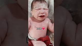 Beautiful and white vernix newborn baby viral baby shorts subscribe ytshorts [upl. by Ainedrag499]