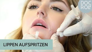 LIPPEN AUFSPRITZEN erklärt  die Behandlung und VorherNachher Ergebnis  Dr Rolf Bartsch [upl. by Zuzana]