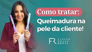 Como tratar a queimadura na pele da cliente [upl. by Aiceled]