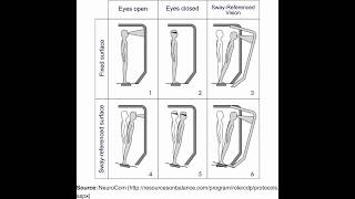 Clinical Test of Sensory Interaction on Balance [upl. by Eninahs961]