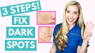 Fix Your Dark Spots in 3 Steps  Hyperpigmentation  Melasma  Skincare Made Simple [upl. by Bradford324]