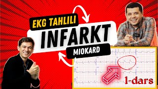 MIOKARD INFARKTI EKG TAHLILI [upl. by Erlandson]