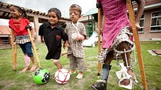 Helping Children Walk Run amp Thrive Child Amputees amp Children with Limb Disabilities [upl. by Esyak203]