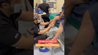 🏩 Cirugía de Várices venasvaricosas varices escleroterapia arañasvenenosas [upl. by Aimit]