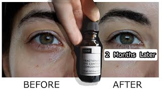 NIOD Fractionated Eye Contour Concentrate Before and After  Two Month Review [upl. by Annohsat]