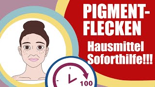 Pigmentflecken Hausmittel Soforthilfe 2021 100 Sekunden Haut [upl. by Sandi935]