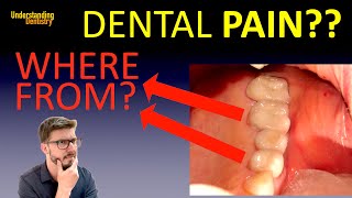 HOW TO KNOW Where the Dental Pain Comes From  pain in tooth after root canal treatment  CBCT [upl. by Allin]