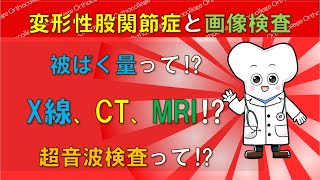 変形性股関節症と画像検査 被ばく量って⁉ レントゲンやCT、MRIは⁉ 【医師が解説】 [upl. by Kandy]