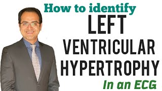 Left Ventricular Hypertrophy ECG Changes Skolow Lyon Criteria Explained ECG Lectures USMLE NEETPG [upl. by Asiak]