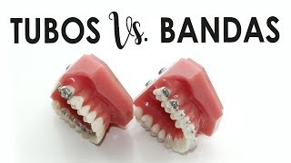 BANDAS Vs TUBOS  ¿QUÉ SON ¿CUÁL ES MEJOR [upl. by Ybbed]