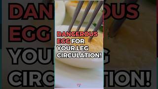 Dangerous Egg For Your Leg Circulation [upl. by Notsgnik]