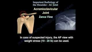 The Shoulder AC JOINT radiology  Everything You Need To Know  Dr Nabil [upl. by Niamart]