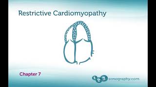 Echocardiography Restrictive Cardiomyopathy with Examples and Echo Demonstration [upl. by Aplihs344]