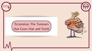 Teratomas Tumours With Eyes Hair and Teeth [upl. by Gilda]