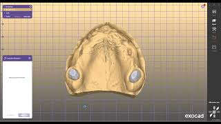 DESIGN DENTAL CROWN COPING FOR EXOCAD exocad [upl. by Azelea]