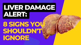 Liver Damage Alert 8 Signs You Shouldnt Ignore [upl. by Secundas]