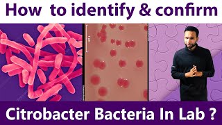 How to Identify amp Confirm Citrobacter Bacteria at Lab [upl. by Gnuhp349]