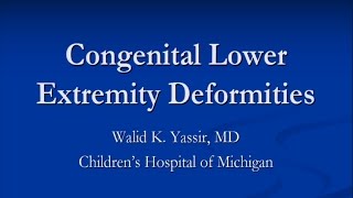 Congenital Lower Extremity Deformities  Dr Yassir [upl. by Daisey]