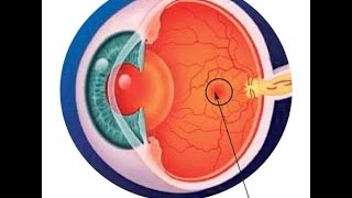 CÓMO EVITAR LA DEGENERACIÓN MACULAR ASOCIADA A LA EDAD Así como la baja visión [upl. by Surazal]