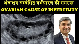 अंडाशय सम्बंधित गर्भधारण की समस्या  OVARIAN CAUSE OF INFERTILITY [upl. by Odraode]