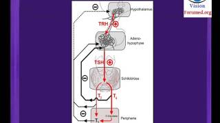 Hypothyroidie comment reconnaitre goitre debutant Glande thyroïdienne nodulaire symptomes nodule [upl. by Can]