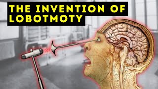 The Man Who Invented the Lobotomy  António Egas Moniz  Documentary [upl. by Kirschner905]