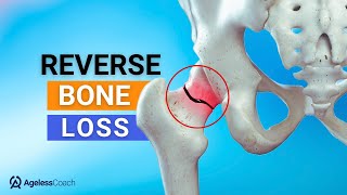 Top 4 Natural Ways To Fix Osteoporosis Reverse Bone Loss [upl. by Carissa283]