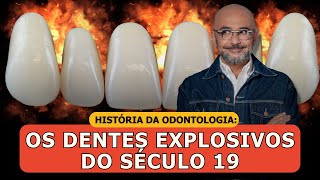 História da Odontologia A Curiosa História dos Dentes Explosivos [upl. by Bravin]