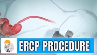 ERCP Endoscopic Retrograde Cholangiopancreatography procedure in 3D [upl. by Sieracki]