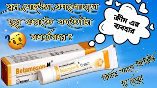 BetamesonN creamবেটামেসনএন এর কাজ কী এবং এর ব্যবহার জানুনত্বকের উজ্জ্বলতা বৃদ্ধিতে সত্যি কাজ করে [upl. by Tallbot]