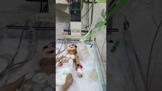 Ventilator machine hai shortvideo ctscan neonatalicu cutebaby neonatalintensivecareunit cute [upl. by Alue566]