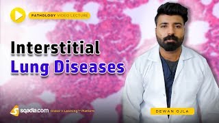 Interstitial Lung Diseases  Pathology Lecture  Medical Education Courses  VLearning [upl. by Hazelton871]