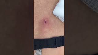 How Satisfying is this DPOW removal [upl. by Jentoft]