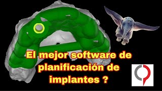 Implastation quick review El mejor software gratuito de planificación de implantes [upl. by Ereynihc347]