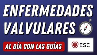 Nueva Guía Enfermedades Valvulares ESC AlDíaConLasGuías [upl. by Ahseryt191]