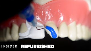 How Damaged Teeth Are Professionally Restored  Refurbished  Insider [upl. by Lemrej]