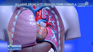 Allarme bronchite cronica come curarla [upl. by Haley27]