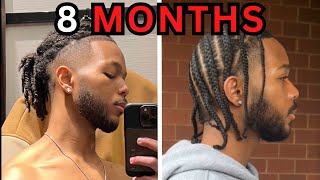 How To Grow Out Your Sides 8 Month Undercut Journey [upl. by Gigi233]