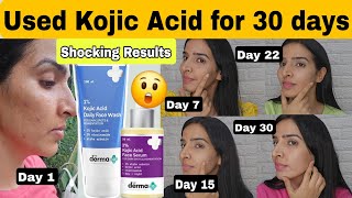 Used Derma co Kojic acid face wash and serum for 30 days 😳 Shocking Results 😨 [upl. by Jehu]