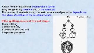 45 General Embryology Monozygotic Twins [upl. by Perle]