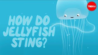 How does a jellyfish sting  Neosha S Kashef [upl. by Ised]