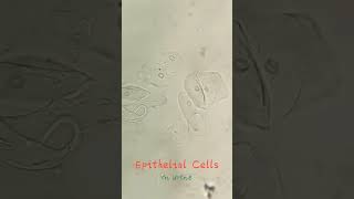 Epithelial cells in Urine [upl. by Ahsratan]