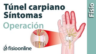 Túnel carpiano  Por qué sigo con síntomas después de operarme [upl. by Bobseine]