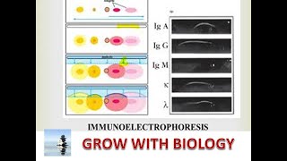 IMMUNOELECTROPHORESIS IN HINDI [upl. by Nilahs]