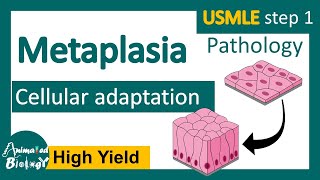 Metaplasia  Cellular adaptation  examples of metaplasia [upl. by Aisatnaf131]