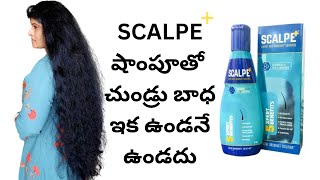 Best Anti Dandruff Shampoo Scalpe detailed review  SCALPE షాంపూతో చుండ్రు బాధ ఇక ఉండనే ఉండదు [upl. by Parette]