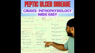 Peptic Ulcer Disease Unveiled How Ulcers Form amp Progress  Pathogenesis Explained [upl. by Notserk]