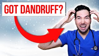 How to get rid of dandruff permanently at home and treatment [upl. by Lleroj]