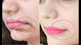 This 1Minute Technique will Remove Mouth Wrinkles amp Lift Corners Of Your Mouth Instantly [upl. by Howard254]